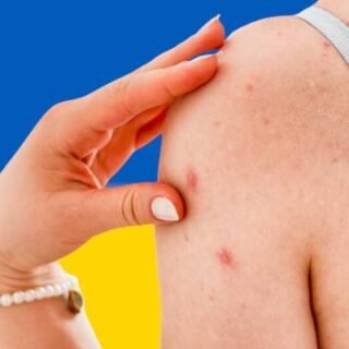 dermatologia